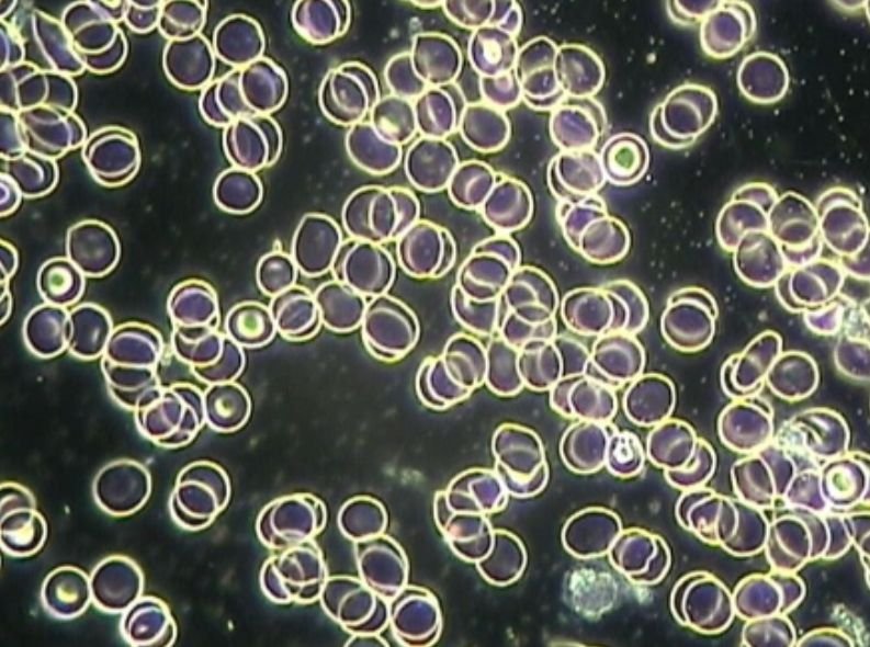 Baseline blood - healthy free-flowing red blood cells