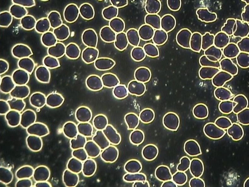 With Quantum Bloc - cells restored