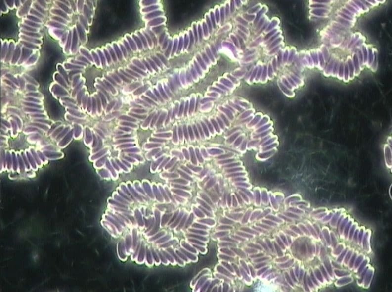 After 10 min WiFi - rouleaux formation